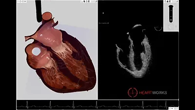 Heartworks